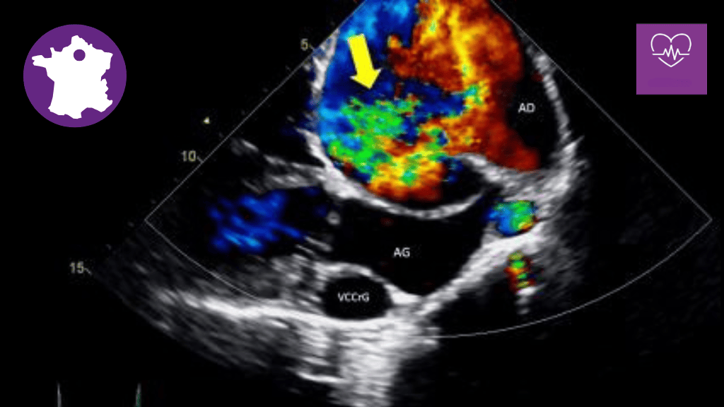 Bannière visuelle de présentation de la formation